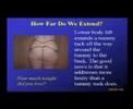 Cosmetic Surgery After Gastric Bypass Cosmetic Surgery After Gastric Bypass