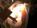 videos de Bilirrubina - Hoy día de SPA!!..