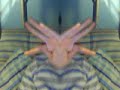 Deformed Hand - 8 fingers
