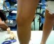 patella tapping of sports injury