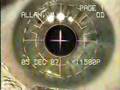 PRK Laser Eye Surgery PRK Laser Eye Surgery