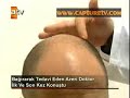 Ba??rarak Tedavi Eden Adam ?ahan G�kbakar