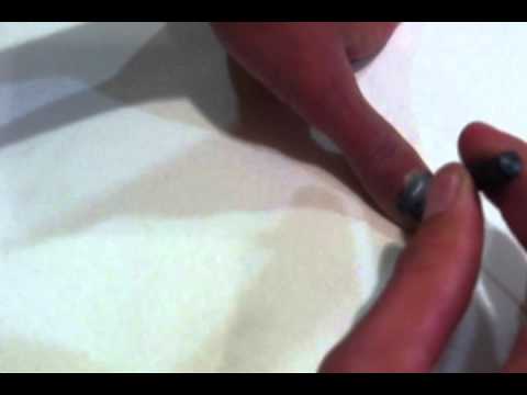 how to relieve smashed fingernail