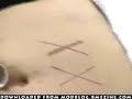 Branding Video of scarification