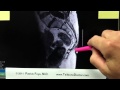 Vitamin E: marker for MRI in Tailbone Pain (Coccyx Pain)
