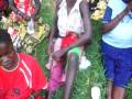 Malnourished Ugandan Baby