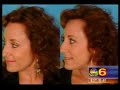 NBC Miami - Hair Care for Thinning Hair & Frizzy Hair NBC Miami - Hair Care for Thinning Hair & Frizzy Hair
