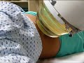 Recomendations to Improve Shock Wave Lithotripsy