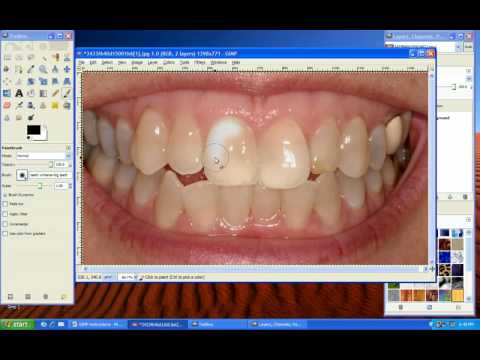 how to whiten teeth using gimp