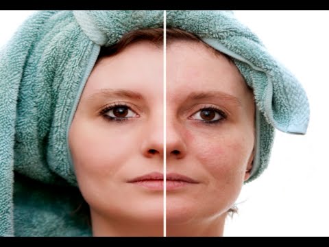 how to eliminate age spots on face