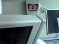 Pt 2 Stem Cell patient hurt by faulty TV whilst in Hospita Pt 2 Stem Cell patient hurt by faulty TV whilst in Hospita