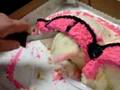 Dr Chris Performs a Breast Cake Reduction