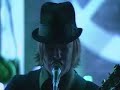 Obstacle 1 - Interpol Obstacle 1 - Interpol