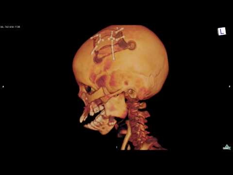how to repair ct scan machine