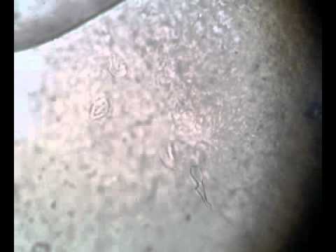 how to isolate entamoeba histolytica