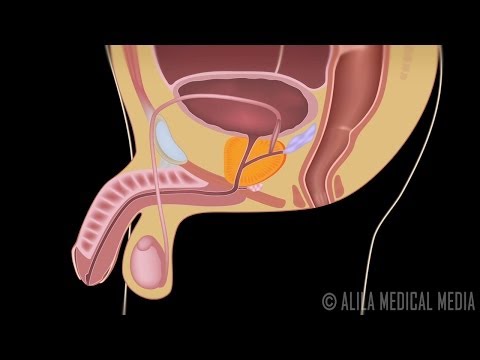 how to treat bph