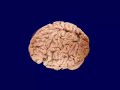 Chimp - Human Brain Morph