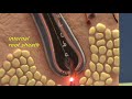 Simple Skin Model - Hair Follicle Simple Skin Model - Hair Follicle