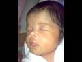 SHEBA MARITHE... Achondroplasia Baby