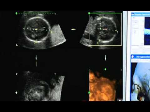 how to become ultrasound tech