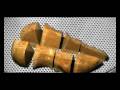 Ricordi Method - Islet Isolation & Transplant for Diabetes