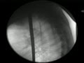 Moving X-ray of Sword Swallower Dan Meyer Swallowing 5 swords for Stan Lee's Superhumans