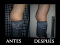 ESTETICA LASER LIPOLASER DR. ALEXIS MUJICA ESTETICA LASER LIPOLASER DR. ALEXIS MUJICA