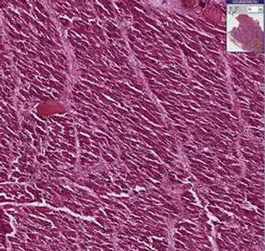 Histopathology Heart--Diphtheria