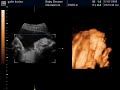 Mi sobrino a los 7 meses, dentro