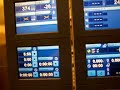 Herzlungenmaschine im Einsatz Herzlungenmaschine im Einsatz