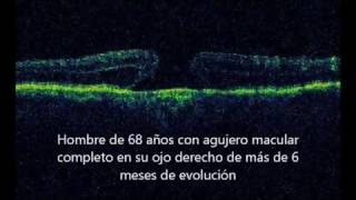 Jeremías Galletti-4