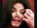 The Uglyness of Michael Jackson
