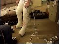 application of a long leg cast