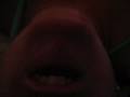 Bouche menton - Mouth chin