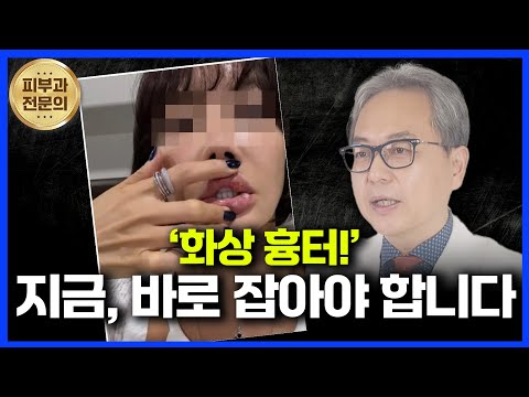 연세스타피부과 TV