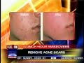 Chicago Lunch Hour Makeovers with Plastic Surgeon Dr. Wiener