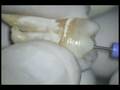 videos de Hand wristwatch motion using SafeSiders