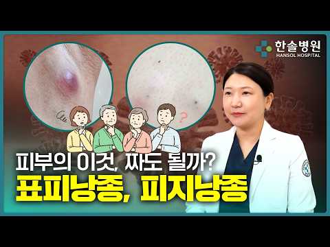  여드름인 줄 알고 짰다가 큰일 납니다! 표피낭종과 피지낭종<span class=