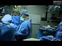 Baby Week - Egyptian Conjoined Twins, Part 2