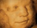 Angel Prints 3D/4D Ultrasound Lafayette & Baton Rouge Angel Prints 3D/4D Ultrasound Lafayette & Baton Rouge