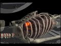 Cancer treatment with respiratory gating