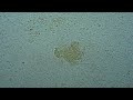 Staphylococcus aureus (pronounced /ˌstæfɨlɵˈkɒkəs ˈɔːriː.əs/, literally the 