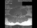 MRI animation