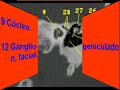 ANATOMIA BASICA EN EL TAC DE PE�ASCOS AXIAL/CORONAL