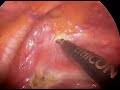 ets-by-dr-konecny.html