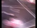 Evan got shot