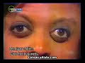 ojos saltones