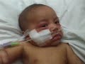 Lincoln Filipo in middlemore hospital 2