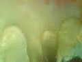 Gunge - Donnay Socks & Classics After the Gunge