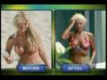 What Happened with Tara Reid's Breast Augmentation and Breast Lift?